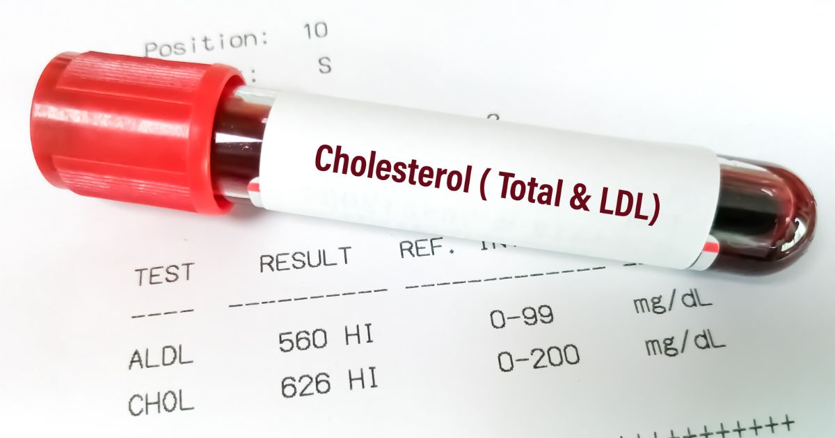 high LDL
