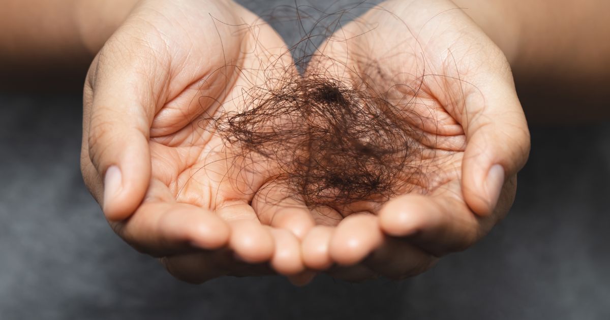 Hair loss after rapid weight loss
