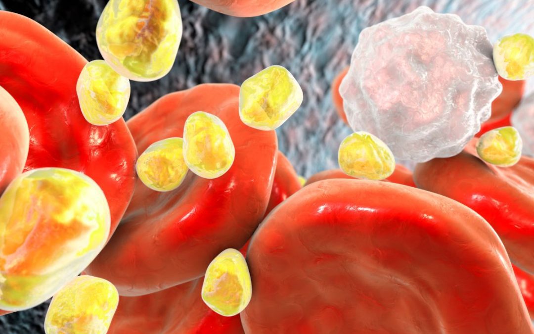 Don’t Worry About ‘Bad’ Cholesterol? Here’s What You Really Need to Know